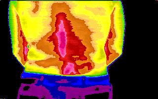lower
                        back thermogram