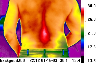 back thermal image
              - musculoskeletal