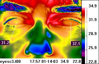 infrared thermogram of eyes