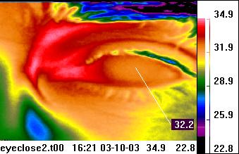 eye infrared image / optic