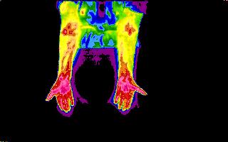 thermogram of
                        hands