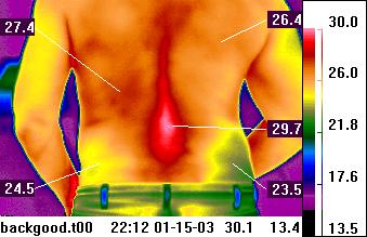 infrared thermal image of the human
                              back