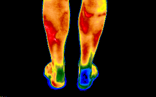 lower extremity