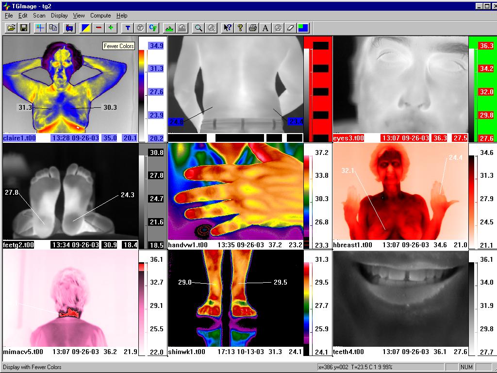 9 image
                                    display of thermograms
