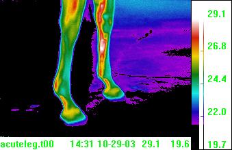 thermal
                  image suspensory ligament