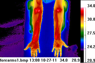 thermogram heat picture of
                                    forearms