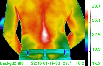 thermal image of back