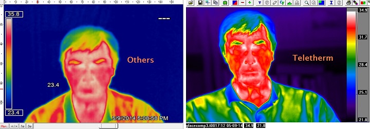 comparison









                                                          of infrared
                                                          imagers view
                                                          of face