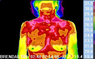 breast images